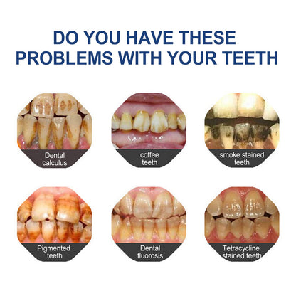 🔥Ends Tonight: Get 60% OFF Before It’s Gone!🎁 YaGoo™ Fluoride-Free Hydroxyapatite Toothpaste – Gentle Whitening & Enamel Strength for Sensitive Teeth